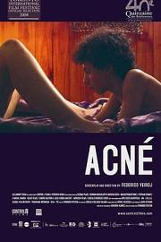 粉刺Acne(2008)插图%4K电影下载_3D影视资源_杜比视界迅雷下载