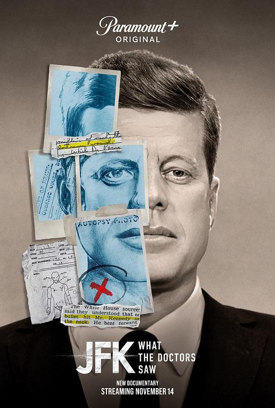 JFK: What the Doctors SawJFK: What the Doctors Saw(2023)插图%4K电影下载_3D影视资源_杜比视界迅雷下载